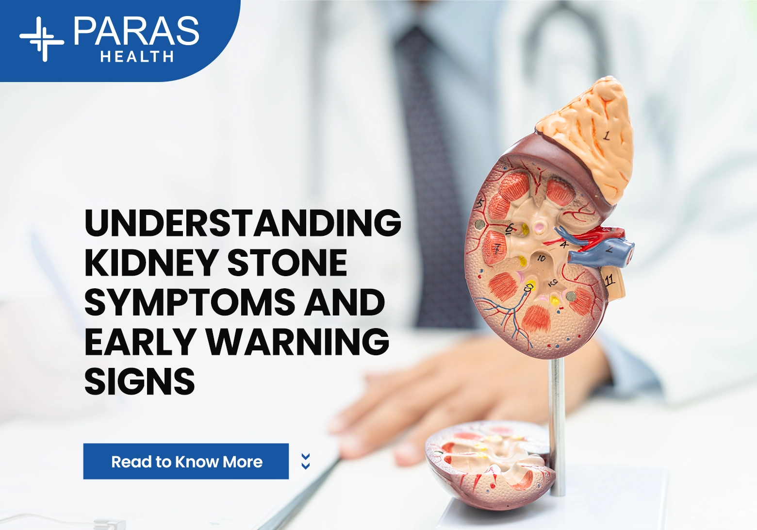 Understanding Kidney Stone Symptoms and Early Warning Signs
